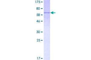 Image no. 1 for Lipase A, Lysosomal Acid, Cholesterol Esterase (LIPA) (AA 1-399) protein (GST tag) (ABIN1309463)