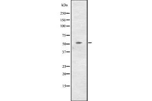 Western blot analysis of CCNL2 expression in NCI-H460 cell line lysates ,The lane on the left is treated with the antigen-specific peptide. (Cyclin L2 anticorps  (C-Term))