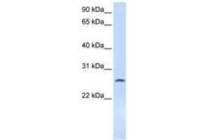 Image no. 1 for anti-Deoxycytidine Kinase (DCK) (AA 108-157) antibody (ABIN6743592) (DCK anticorps  (AA 108-157))