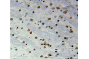 anti-Nucleoporin 35kDa (NUP35) (AA 132-310) antibody