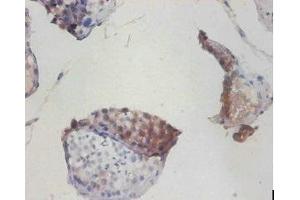 Immunohistochemistry of paraffin-embedded human testis tissue using ABIN7149175 at dilution of 1:100
