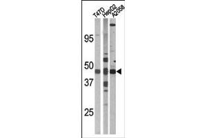 Image no. 2 for anti-E2F Transcription Factor 1 (E2F1) (pSer337) antibody (ABIN358119) (E2F1 anticorps  (pSer337))
