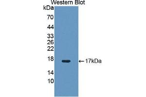 Western blot analysis of the recombinant protein. (NR4A3 anticorps  (AA 29-145))