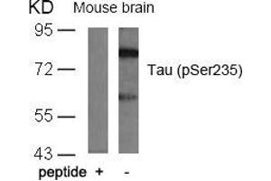 Western blot analysis of extracts from mouse brain tissue using Tau(Phospho-Ser235) Antibody and the same antibody preincubated with blocking peptide. (MAPT anticorps  (pSer235))