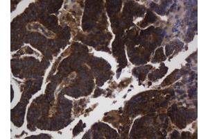 Image no. 3 for anti-Asialoglycoprotein Receptor 2 (ASGR2) antibody (ABIN1496744)