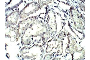 Detecting C4a in Baboon Liver using ABIN2749472 (C4A anticorps  (AA 1220-1270))