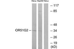 Western blot analysis of extracts from HeLa/HepG2 cells, using OR51G2 Antibody. (OR51G2 anticorps  (AA 211-260))