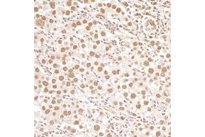 Immunohistochemistry (IHC) image for anti-Structural Maintenance of Chromosomes 1A (SMC1A) (pSer966) antibody (ABIN7455211) (SMC1A anticorps  (pSer966))