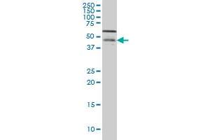 CSNK1G1 monoclonal antibody (M04), clone 8A4 Western Blot analysis of CSNK1G1 expression in Hela S3 NE . (CSNK1G1 anticorps  (AA 293-393))