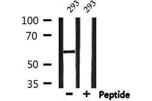 Western blot analysis of extracts from 293, using YTHDF1 Antibody. (YTHDF1 anticorps  (N-Term))