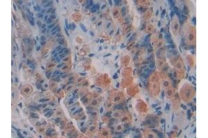 Detection of TFAM in Mouse Stomach Tissue using Polyclonal Antibody to Transcription Factor A, Mitochondrial (TFAM)