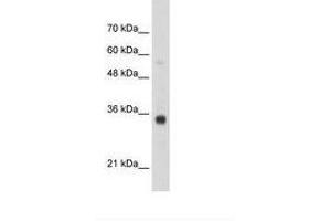 Image no. 1 for anti-Homeobox B4 (HOXB4) (N-Term) antibody (ABIN203345) (HOXB4 anticorps  (N-Term))