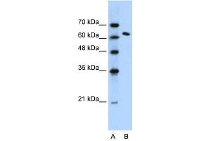 SUPT16H antibody (20R-1066) used at 0. (SUPT16H anticorps  (N-Term))