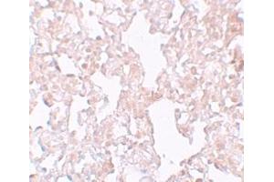 Immunohistochemistry (IHC) image for anti-Major Facilitator Superfamily Domain Containing 1 (MFSD1) (Middle Region) antibody (ABIN1031003) (MFSD1 anticorps  (Middle Region))