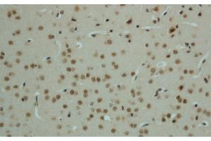 Immunohistochemistry of paraffin-embedded mouse brain using Phospho-AMPK alpha1/2 (Thr183/172) Polyclonal Antibody at dilution of 1:50 (PRKAA1/PRKAA2 anticorps  (pThr172, pThr183))
