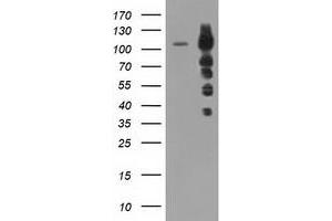 HEK293T cells were transfected with the pCMV6-ENTRY control (Left lane) or pCMV6-ENTRY TACC3 (Right lane) cDNA for 48 hrs and lysed. (TACC3 anticorps)