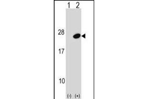 Western blot analysis of UBE2G1 (arrow) using rabbit polyclonal UBE2G1 Antibody (C-term) (ABIN1536693 and ABIN2848805).