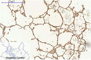Immunohistochemical analysis of paraffin-embedded human lung tissue. (Caspase 9 anticorps)