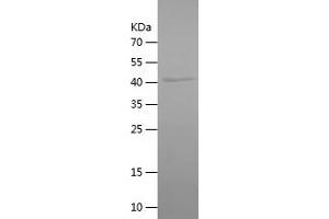 Western Blotting (WB) image for Orosomucoid 2 (ORM2) (AA 19-201) protein (His-IF2DI Tag) (ABIN7124275)