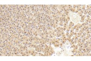 Detection of FIGN in Human Liver Tissue using Polyclonal Antibody to Fidgetin (FIGN) (Fidgetin anticorps  (AA 1-308))