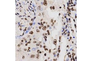 Immunohistochemistry (IHC) image for anti-Histone H3 (H3) (H3K27me) antibody (ABIN3023266)