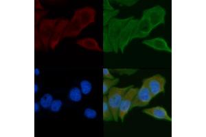 ABIN6257883 and ABIN6275262 staining Hela cells by IF/ICC. (MYOM2 anticorps  (Internal Region))