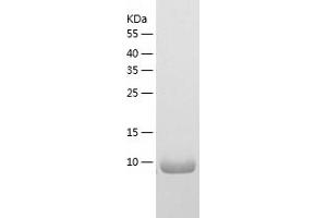 Western Blotting (WB) image for S100 Calcium Binding Protein A1 (S100A1) (AA 1-94) protein (His-IF2DI Tag) (ABIN7124944)