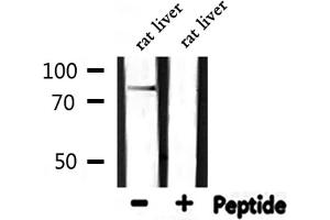 Western blot analysis of extracts from rat liver, using CDH18 Antibody. (CDH18 anticorps  (N-Term))
