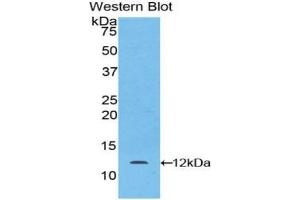 Western blot analysis of the recombinant protein. (LAMB2 anticorps  (AA 1176-1309))