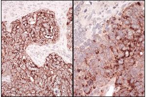 Immunohistochemistry (IHC) image for anti-Heat Shock 60kDa Protein 1 (Chaperonin) (HSPD1) (AA 50-100) antibody (ABIN7454872)