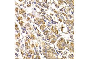 Immunohistochemistry of paraffin-embedded human stomach using METTL7B antibody at dilution of 1:100 (40x lens). (METTL7B anticorps)