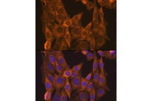 Immunofluorescence analysis of NIH/3T3 cells using RARα Rabbit pAb (ABIN6128615, ABIN6146692, ABIN6146695 and ABIN6213825) at dilution of 1:100 (40x lens).