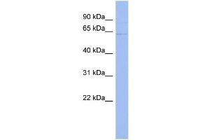 WB Suggested Anti-UPF3A Antibody Titration:  0. (UPF3A anticorps  (Middle Region))