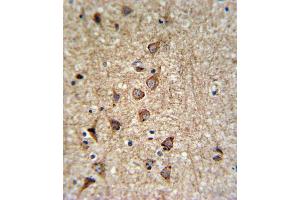 Immunohistochemistry (IHC) image for anti-Solute Carrier Family 25, Member 37 (SLC25A37) antibody (ABIN3004289)