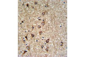 Immunohistochemistry (IHC) image for anti-Solute Carrier Family 25, Member 37 (SLC25A37) antibody (ABIN3004289) (SLC25A37 anticorps)