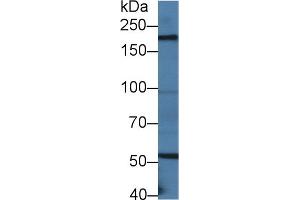 Western Blot; Sample: Mouse Small intestine lysate; ;Primary Ab: 2µg/ml Rabbit Anti-Mouse LAMb2 Antibody;Second Ab: 0. (LAMB2 anticorps  (AA 1498-1716))