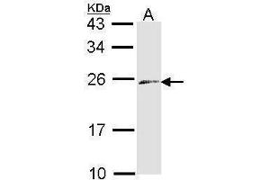 WB Image Sample (30 ug of whole cell lysate) A: Raji 12% SDS PAGE antibody diluted at 1:1000 (Endothelin 3 anticorps)
