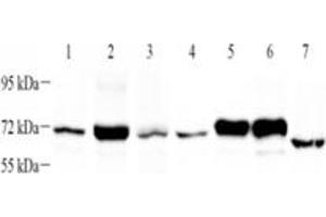 Western blot analysis of PLAP (ABIN7075090),at dilution of 1: 1000,Lane 1: HeLa cell lysate,Lane 2: HaCaT cell lysate,Lane 3: SiHa cell lysate,Lane 4: SKBR3 cell lysate,Lane 5: HepG2 cell lysate,Lane 6: A431 cell lysate,Lane 7: Mouse uterus tissue lysate (PLAP anticorps)