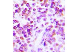 Immunohistochemical analysis of TNF alpha staining in human tonsil formalin fixed paraffin embedded tissue section. (TNF alpha anticorps  (Center))