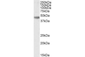 (ABIN185622) (0. (Casein Kinase 1 delta anticorps  (Internal Region))