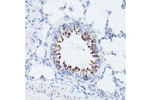 Immunohistochemistry of paraffin-embedded rat lung using ErbB2 antibody.