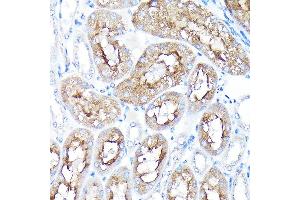 Immunohistochemistry of paraffin-embedded mouse kidney using PEG10 Rabbit pAb (ABIN3016692, ABIN3016693, ABIN1681320 and ABIN6219814) at dilution of 1:100 (40x lens). (PEG10 anticorps  (AA 1-325))