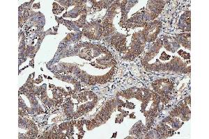 IHC analysis of PPP2CA using anti-PPP2CA antibody (ABIN3043356). (PPP2CA anticorps  (AA 1-309))