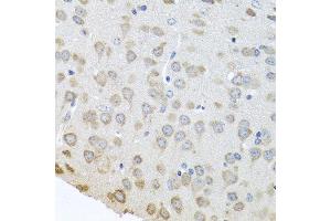 Immunohistochemistry of paraffin-embedded mouse brain using PABPC4 antibody at dilution of 1:100 (40x lens).