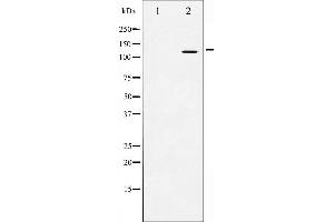 Western blot analysis of Amyloid beta A4 expression in HeLa whole cell lysates,The lane on the left is treated with the antigen-specific peptide. (APP anticorps  (C-Term))