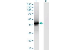 Western Blot analysis of LCAT expression in transfected 293T cell line by LCAT monoclonal antibody (M01), clone 4A9.