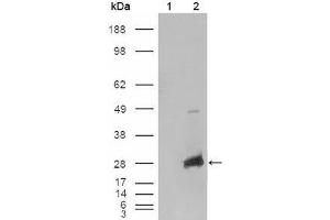 Western blot analysis using CRYAB mouse mAb against HEK293T cells transfected with the pCMV6-ENTRY control (1) and pCMV6-ENTRY CRYAB cDNA (2).
