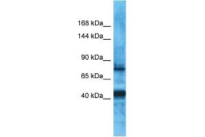 Host:  Rabbit  Target Name:  PDZRN3  Sample Type:  Uterus Tumor lysates  Antibody Dilution:  1. (PDZRN3 anticorps  (Middle Region))
