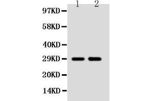 Anti-SSX2 antibody, Western blotting Lane 1: MCF-7 Cell Lysate Lane 2: HELA Cell Lysate (SSX2 anticorps  (C-Term))