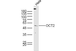 HeLa lysates probed with Rabbit Anti-OCT2 Polyclonal Antibody, Unconjugated  at 1:300 overnight at 4˚C. (Oct-2 anticorps  (AA 11-100))